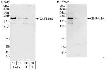 Rabbit anti-ZNF518A Antibody