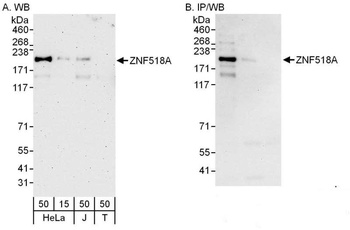 ZNF518A Antibody