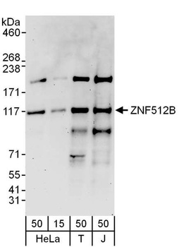 ZNF512B Antibody