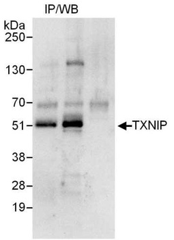 TXNIP Antibody