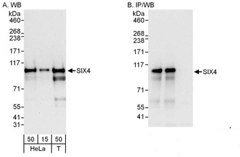 Rabbit anti-SIX4 Antibody