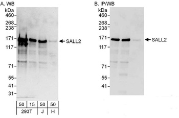 Rabbit anti-SALL2 Antibody