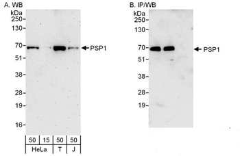 PSP1 Antibody