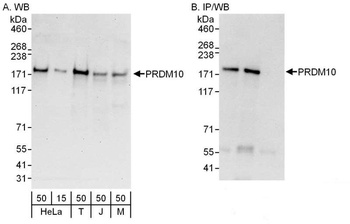 Rabbit anti-PRDM10 Antibody
