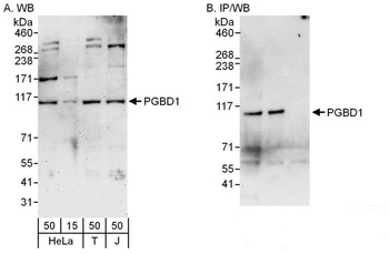 Rabbit anti-PGBD1 Antibody