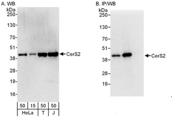 Rabbit anti-CerS2 Antibody