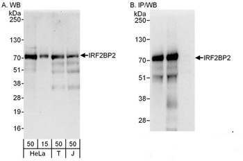 Rabbit anti-IRF2BP2 Antibody
