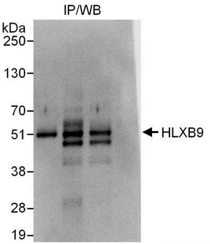 HLXB9 Antibody