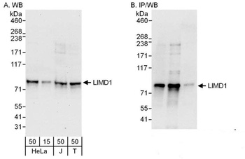 Rabbit anti-LIMD1 Antibody