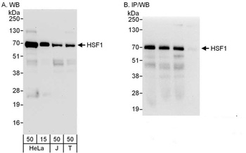 Rabbit anti-HSF1 Antibody
