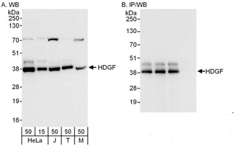 Rabbit anti-HDGF Antibody