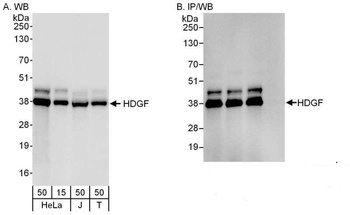 Rabbit anti-HDGF Antibody