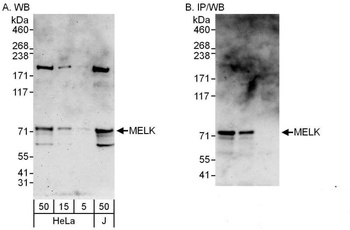 Rabbit anti-MELK Antibody