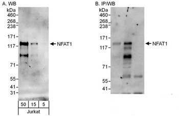 NFAT1 Antibody