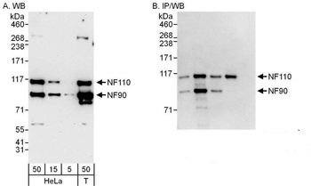 NF90/NF110 Antibody
