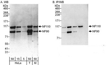 NF90/NF110 Antibody