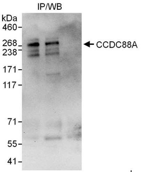 CCDC88A Antibody