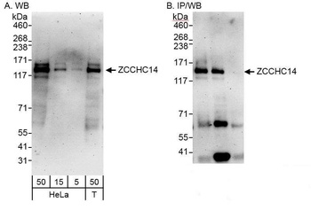 ZCCHC14 Antibody