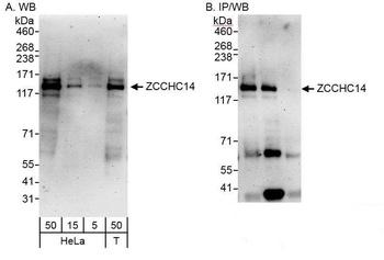 Rabbit anti-ZCCHC14 Antibody