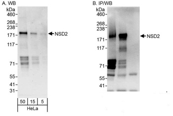 Rabbit anti-NSD2 Antibody