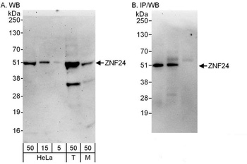 Rabbit anti-ZNF24 Antibody