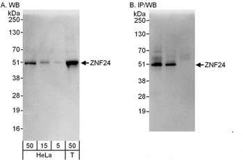 Rabbit anti-ZNF24 Antibody
