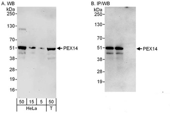 Rabbit anti-PEX14 Antibody