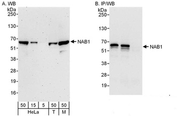 Rabbit anti-NAB1 Antibody