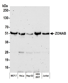 ZONAB Antibody