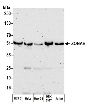 Rabbit anti-ZONAB Antibody