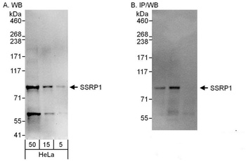 Rabbit anti-SSRP1 Antibody