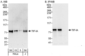 TIF-IA Antibody