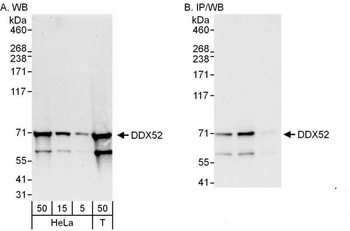 Rabbit anti-DDX52 Antibody