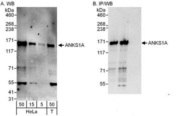Rabbit anti-ANKS1A Antibody