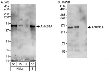 Rabbit anti-ANKS1A Antibody