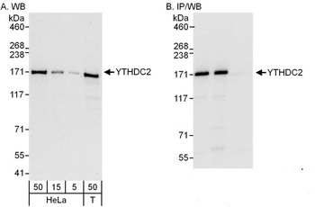 Rabbit anti-YTHDC2 Antibody
