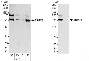 Rabbit anti-TRPC6 Antibody