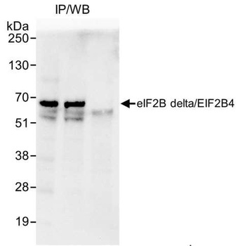 eIF2B delta/EIF2B4 Antibody