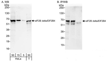 eIF2B delta/EIF2B4 Antibody