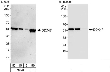 DDX47 Antibody