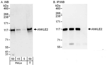 Rabbit anti-ANKLE2 Antibody