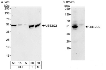 Rabbit anti-UBE2Q2 Antibody