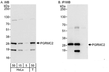 PGRMC2 Antibody