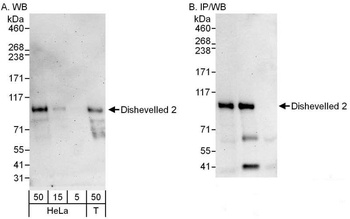 Rabbit anti-Dishevelled 2 Antibody