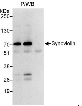 Rabbit anti-Synoviolin Antibody