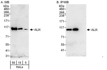 Rabbit anti-ALIX Antibody