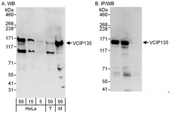 Rabbit anti-VCIP135 Antibody