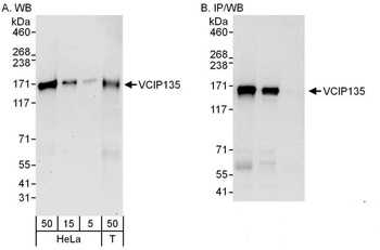 Rabbit anti-VCIP135 Antibody