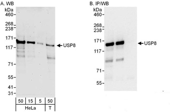 Rabbit anti-USP8 Antibody