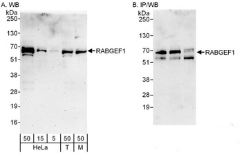 Rabbit anti-RABGEF1 Antibody